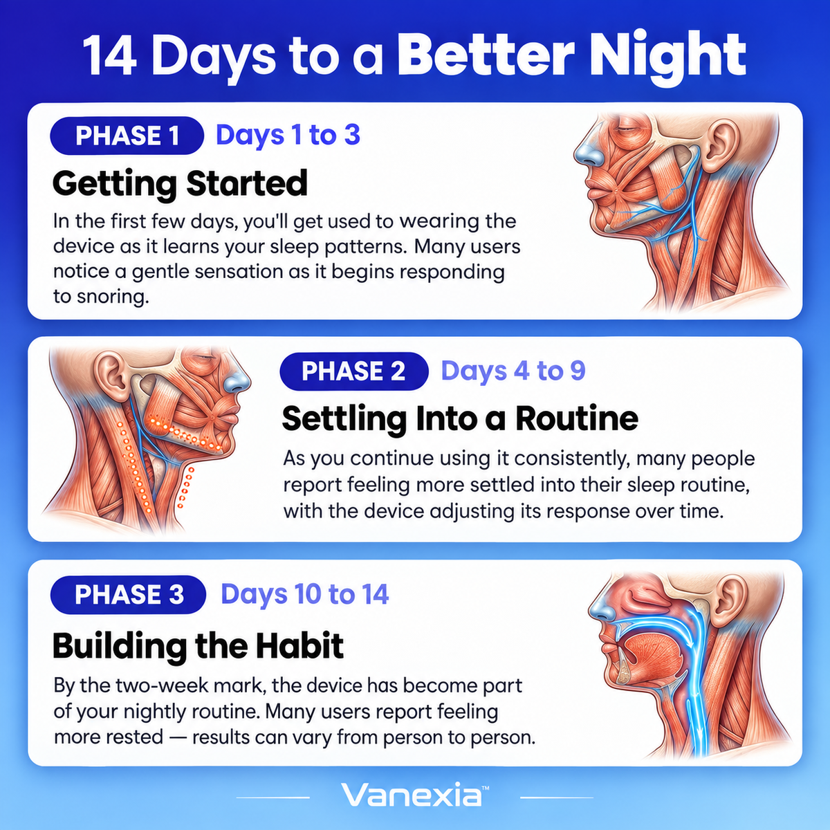 Snorvia™ Anti-Snoring Device